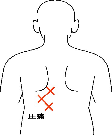 今治　玄鍼灸院　背中の痛み