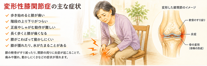 玄鍼灸院　今治　変形性膝関節症